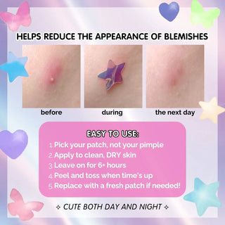 Holographic Star Hydrocolloid Pimple Patches (26 Count) – Cute Acne Spot Stickers for Blemish Care, Oil Absorption & Skin Protection
