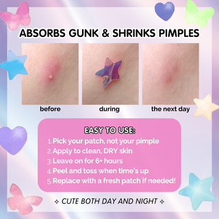 Holographic Heart Hydrocolloid Pimple Patches (78 Count) – Cute Acne Spot Stickers for Blemish Care, Oil Absorption & Skin Protection 💜